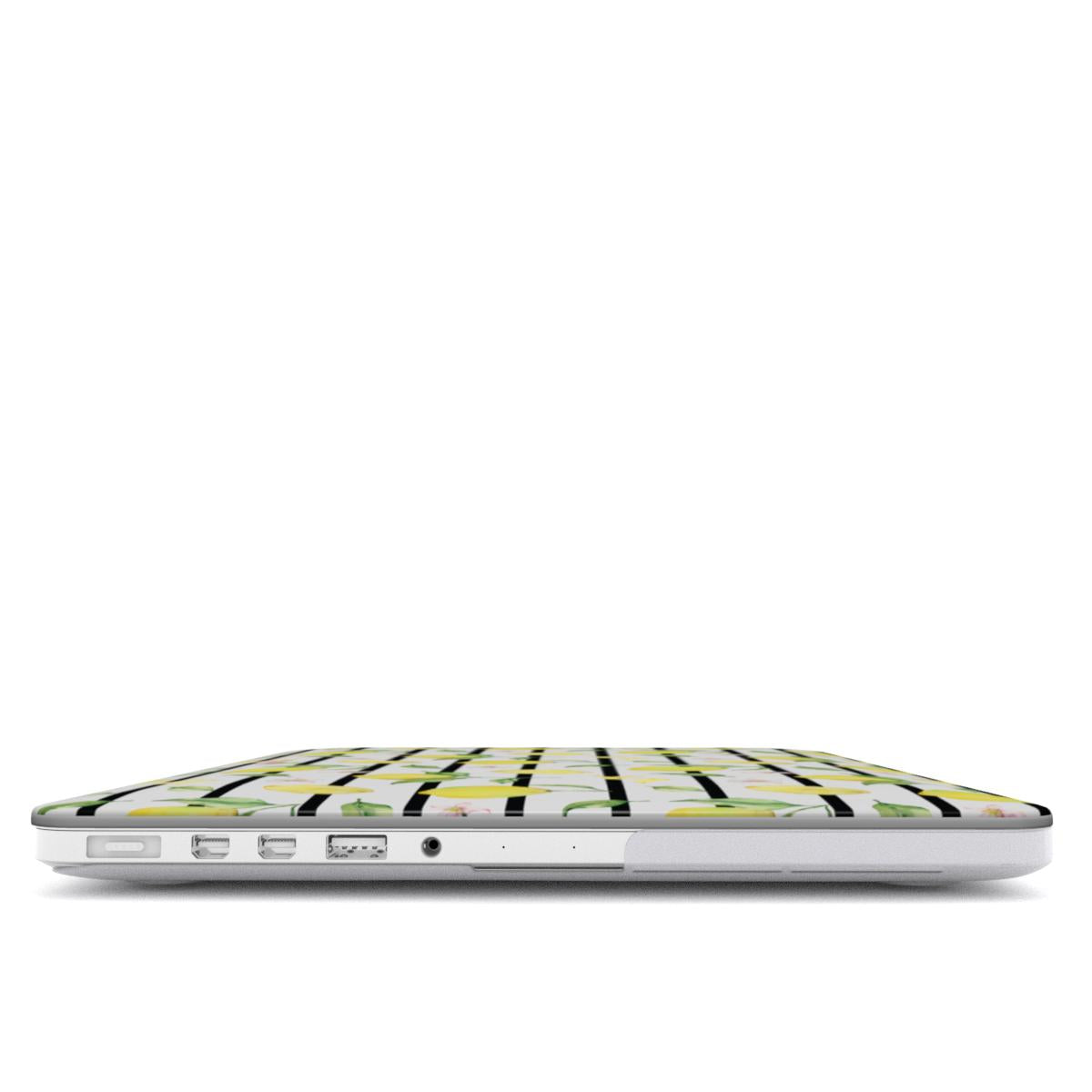 Macbook dėklas - Squeeze the Day