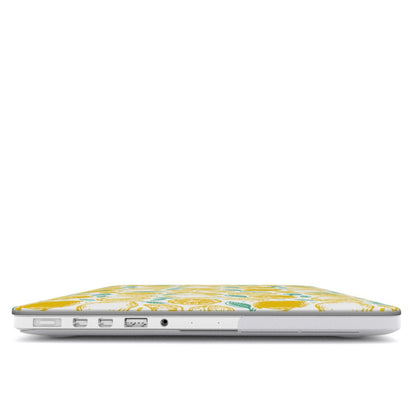 Macbook dėklas - Lemonlush