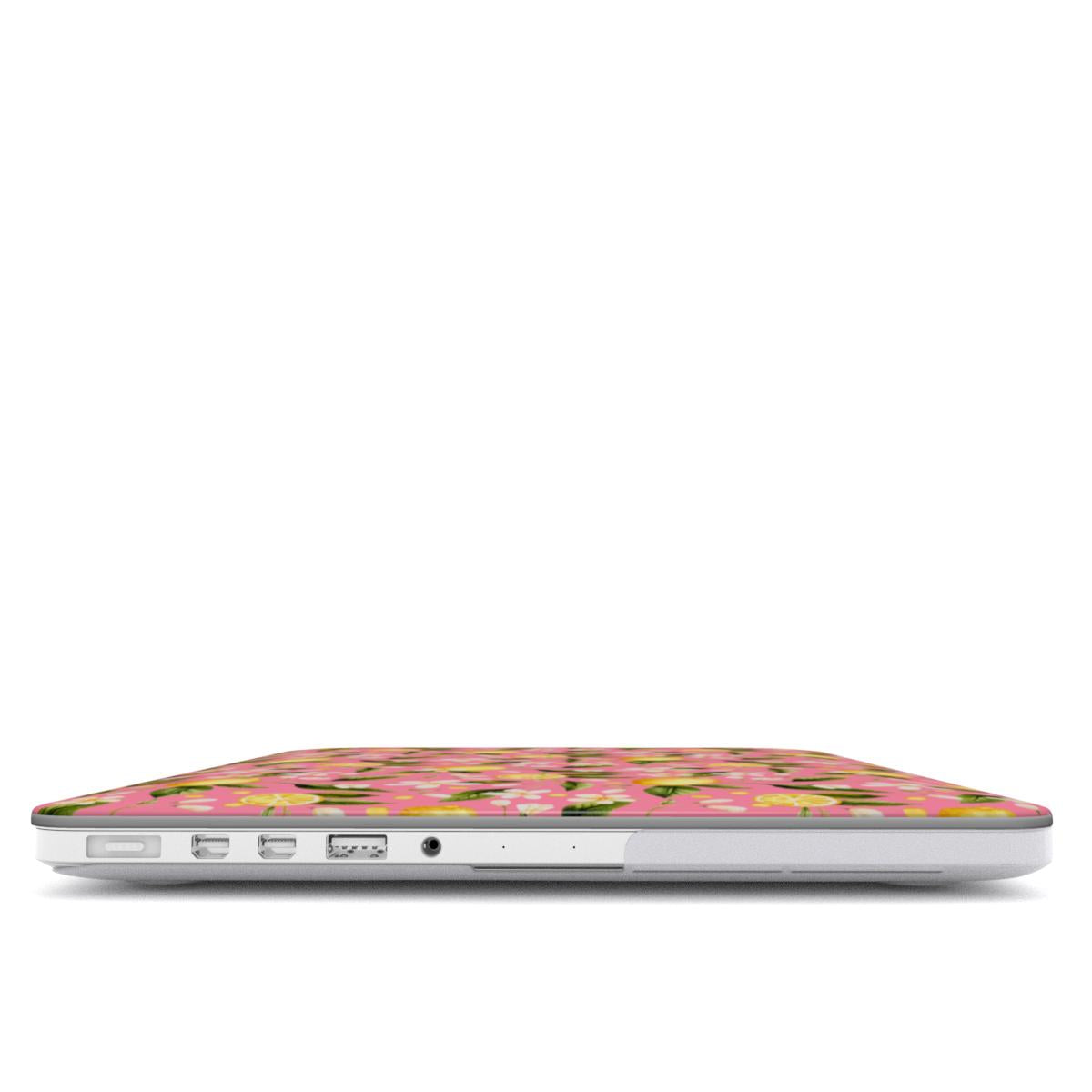 Macbook dėklas - Golden Zest