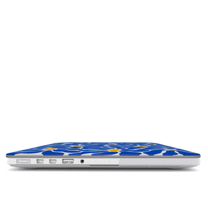 Macbook dėklas - Color Bloom